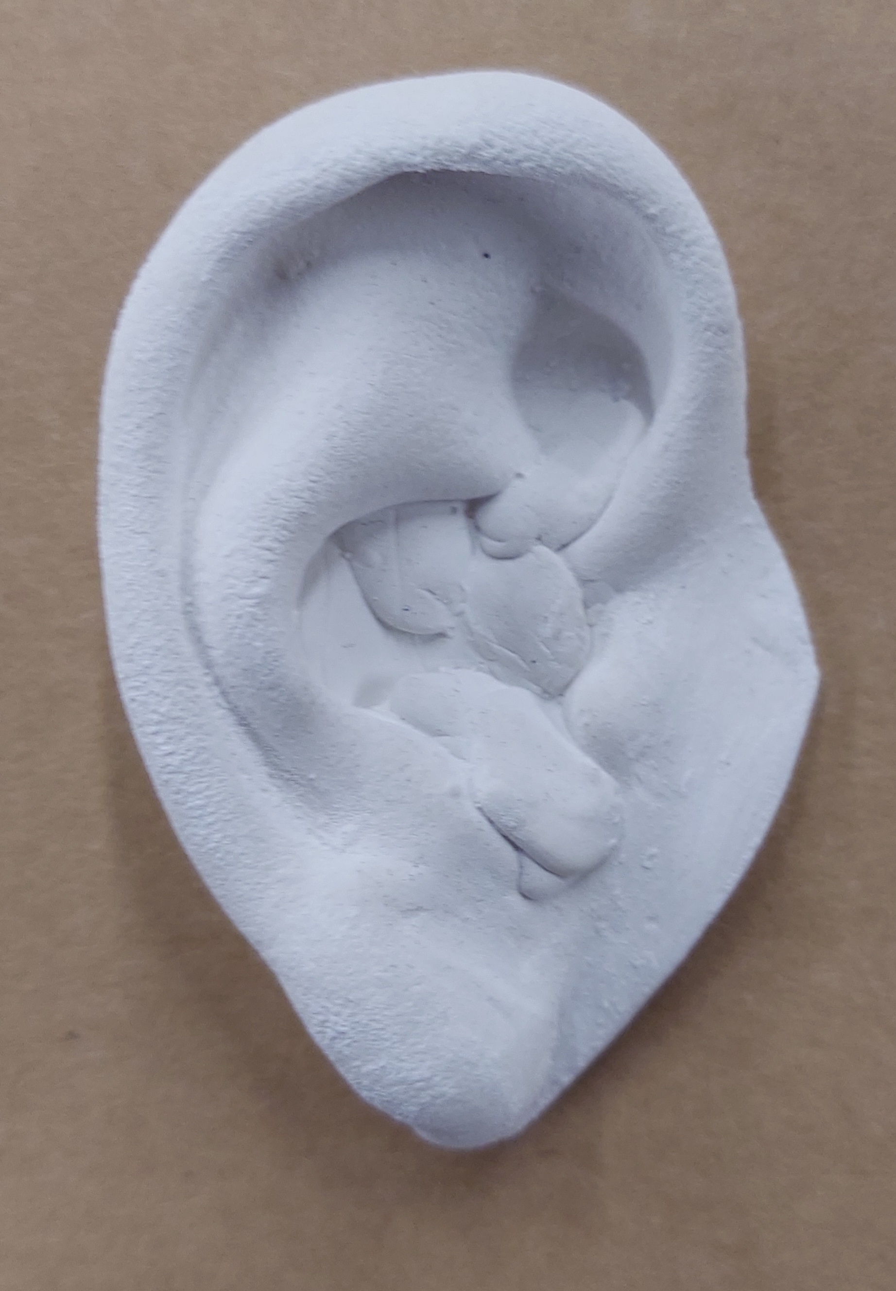 Ear Cast